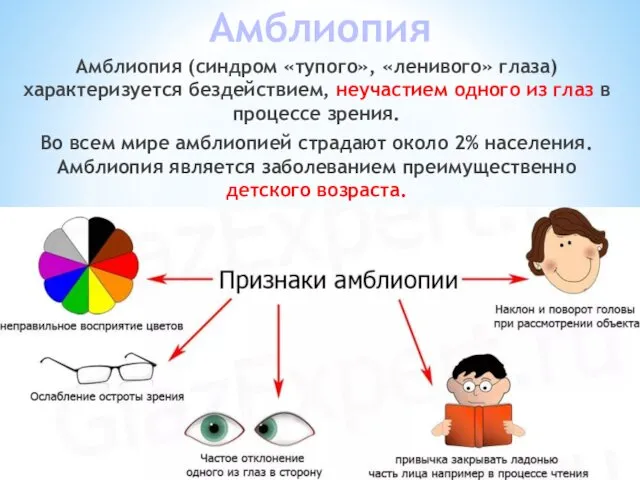 Амблиопия Амблиопия (синдром «тупого», «ленивого» глаза) характеризуется бездействием, неучастием одного из