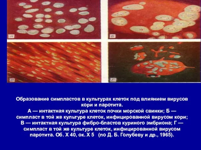 Образование симпластов в культурах клеток под влиянием вирусов кори и паротита.