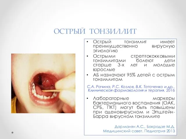 ОСТРЫЙ ТОНЗИЛЛИТ Острый тонзиллит имеет преимущественно вирусную этиологию Острыми стрептококковыми тонзиллитами