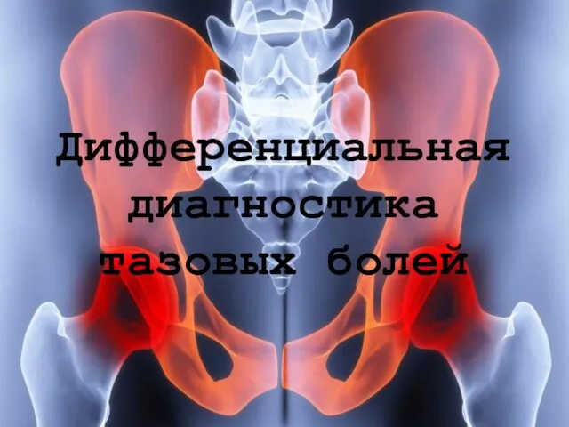 Дифференциальная диагностика тазовых болей