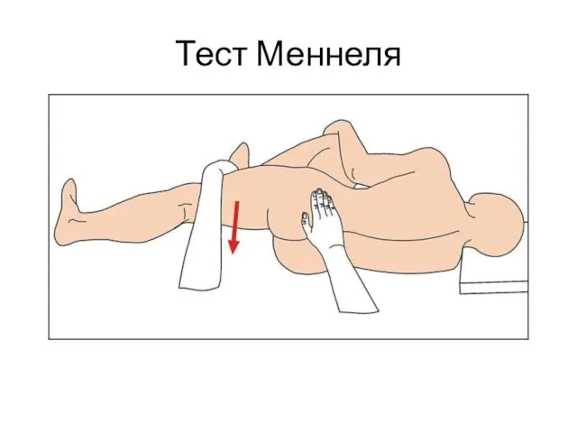 Тест Меннеля