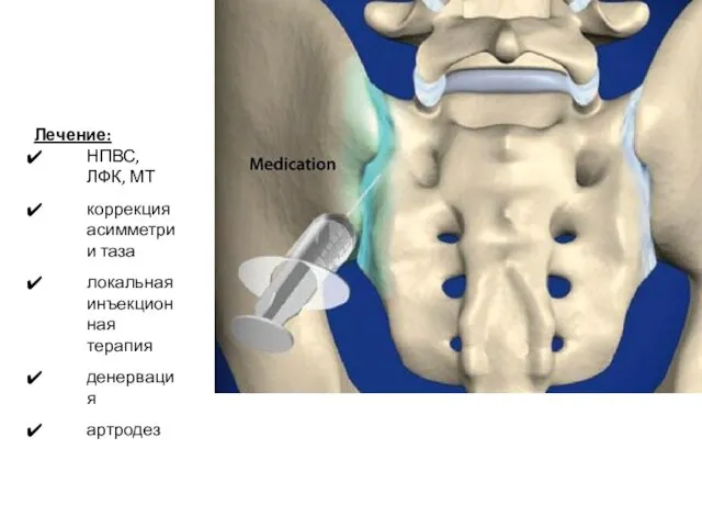 Лечение: НПВС, ЛФК, МТ коррекция асимметрии таза локальная инъекционная терапия денервация артродез