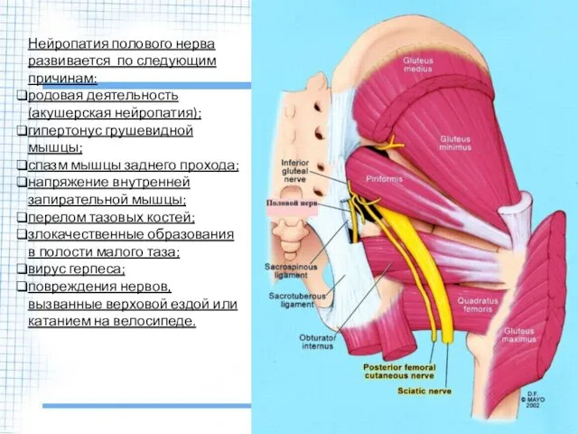 Нейропатия полового нерва развивается по следующим причинам: родовая деятельность (акушерская нейропатия);