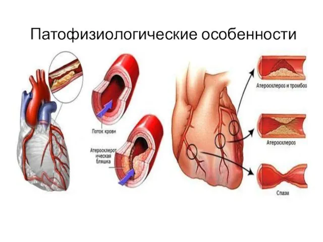 Патофизиологические особенности