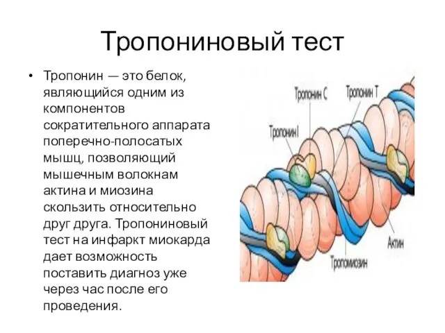 Тропониновый тест Тропонин — это белок, являющийся одним из компонентов сократительного