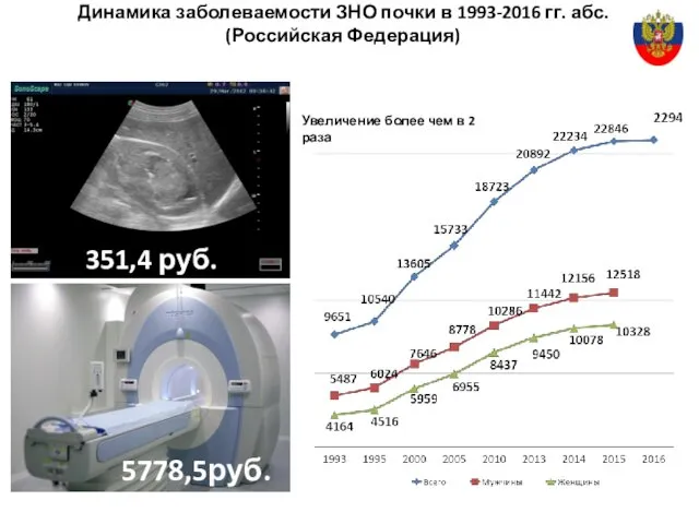 Динамика заболеваемости ЗНО почки в 1993-2016 гг. абс. (Российская Федерация) Увеличение