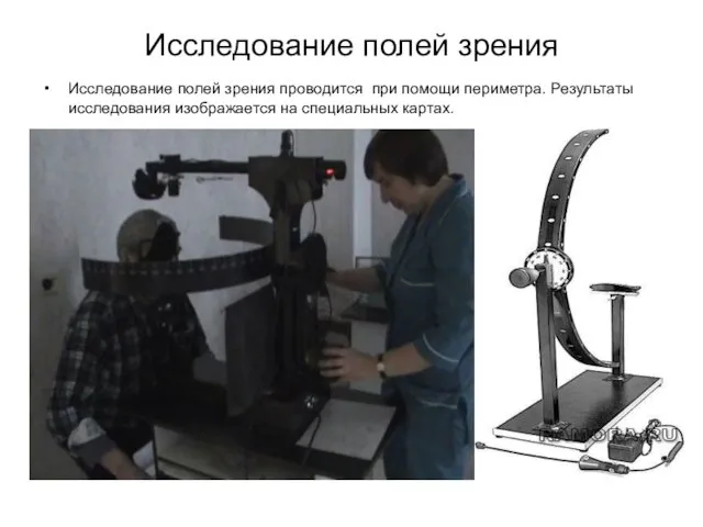 Исследование полей зрения Исследование полей зрения проводится при помощи периметра. Результаты исследования изображается на специальных картах.