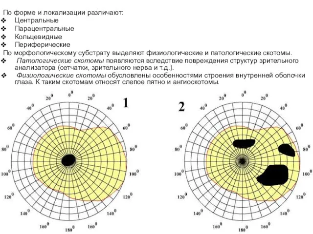 По форме и локализации различают: Центральные Парацентральные Кольцевидные Периферические По морфологическому