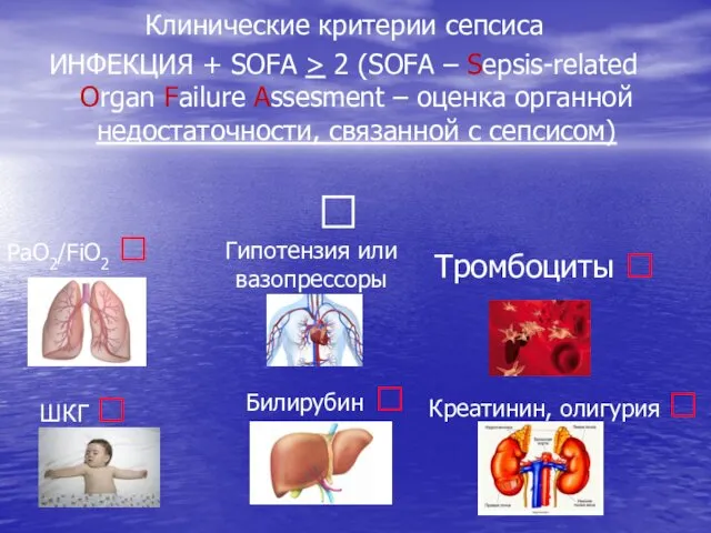 Клинические критерии сепсиса ИНФЕКЦИЯ + SOFA > 2 (SOFA – Sepsis-related