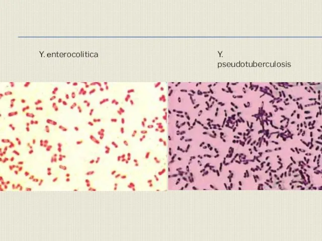 Y. pseudotuberculosis Y. еnterocolitica