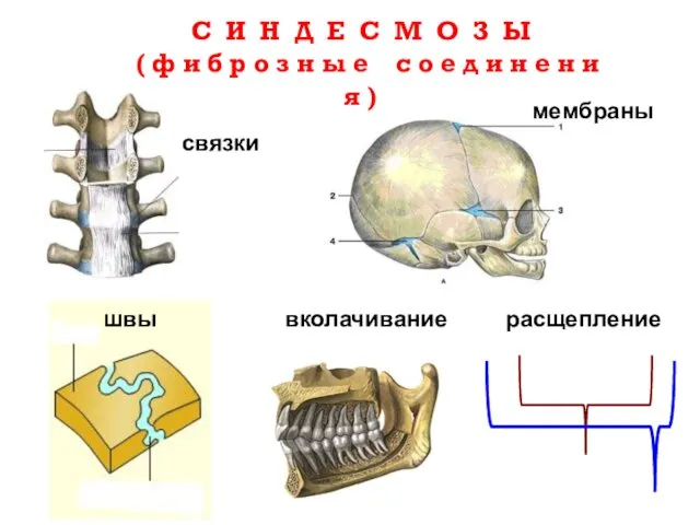 С И Н Д Е С М О З Ы (