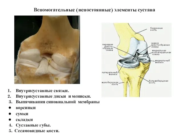 Вспомогательные (непостоянные) элементы сустава Внутрисуставные связки. Внутрисуставные диски и мениски. 3.