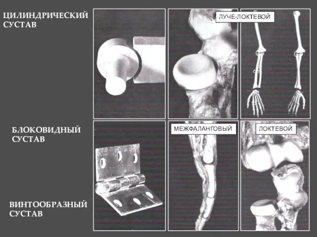 БЛОКОВИДНЫЙ СУСТАВ ВИНТООБРАЗНЫЙ СУСТАВ МЕЖФАЛАНГОВЫЙ ЛОКТЕВОЙ ЦИЛИНДРИЧЕСКИЙ СУСТАВ ЛУЧЕ-ЛОКТЕВОЙ