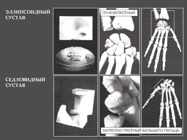ЭЛЛИПСОИДНЫЙ СУСТАВ ЛУЧЕЗАПЯСТНЫЙ СЕДЛОВИДНЫЙ СУСТАВ ЗАПЯСТН0-ПЯСТНЫЙ БОЛЬШОГО ПАЛЬЦА
