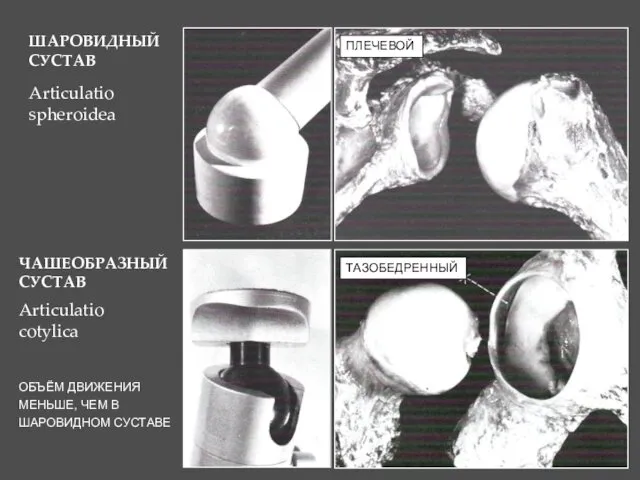 ШАРОВИДНЫЙ СУСТАВ ЧАШЕОБРАЗНЫЙ СУСТАВ ПЛЕЧЕВОЙ ТАЗОБЕДРЕННЫЙ ОБЪЁМ ДВИЖЕНИЯ МЕНЬШЕ, ЧЕМ В