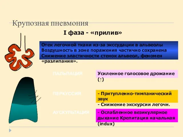 Крупозная пневмония I фаза - «прилив» ПАЛЬПАЦИЯ ПЕРКУССИЯ АУСКУЛЬТАЦИЯ Отек легочной