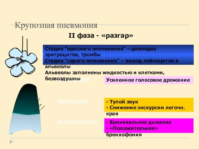 Крупозная пневмония II фаза - «разгар» ПАЛЬПАЦИЯ ПЕРКУССИЯ АУСКУЛЬТАЦИЯ Стадия "красного