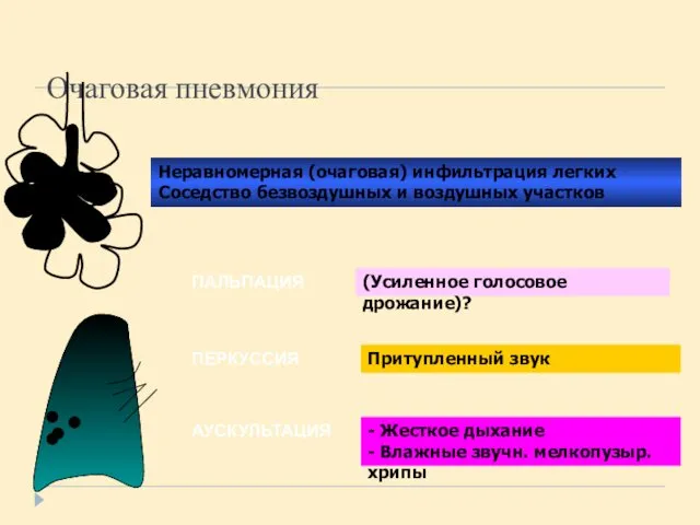 Очаговая пневмония ПАЛЬПАЦИЯ ПЕРКУССИЯ АУСКУЛЬТАЦИЯ Неравномерная (очаговая) инфильтрация легких Соседство безвоздушных