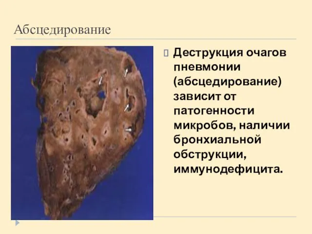 Абсцедирование Деструкция очагов пневмонии (абсцедирование) зависит от патогенности микробов, наличии бронхиальной обструкции, иммунодефицита.