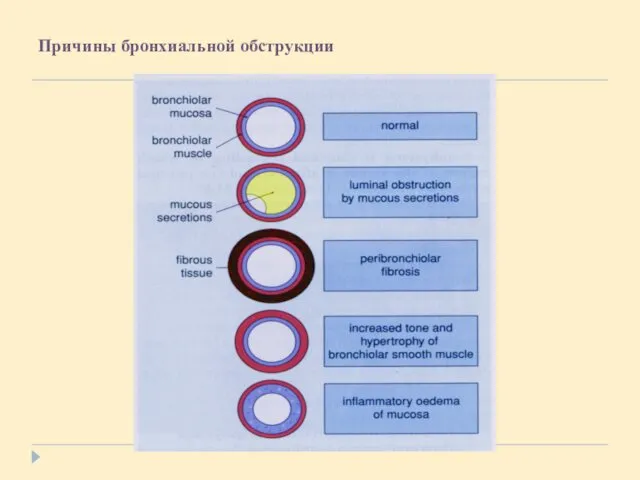 Причины бронхиальной обструкции