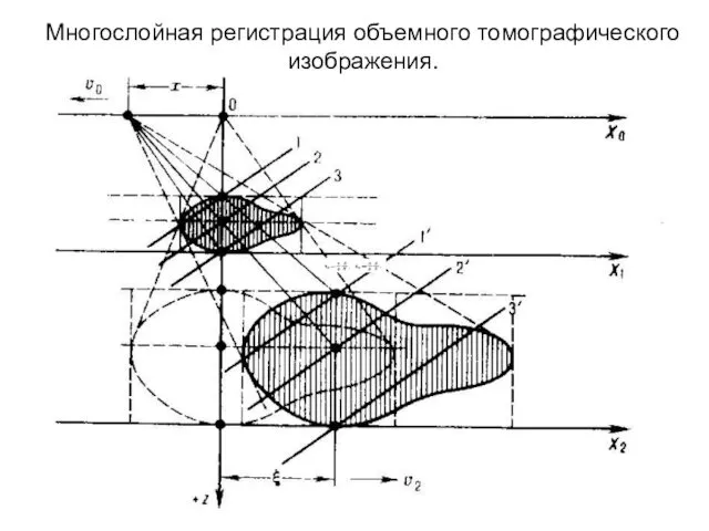 Многослойная регистрация объемного томографического изображения.