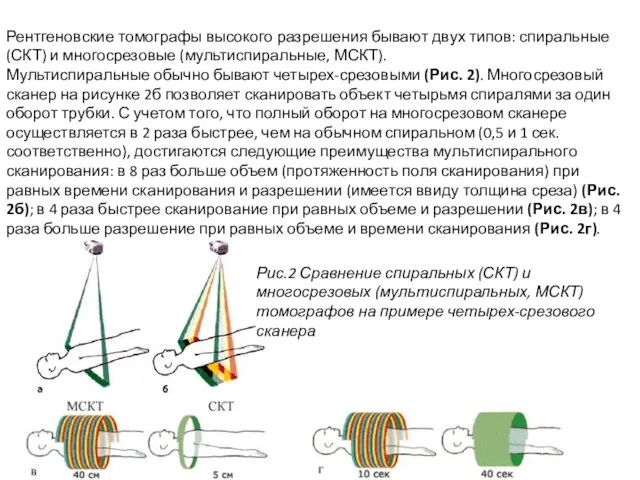 Рентгеновские томографы высокого разрешения бывают двух типов: спиральные (СКТ) и многосрезовые