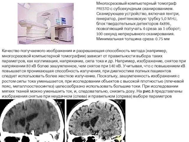 Многосрезовый компьютерный томограф PRESTO с субсекундным сканированием. Сканирующее устройство, включая гентри,