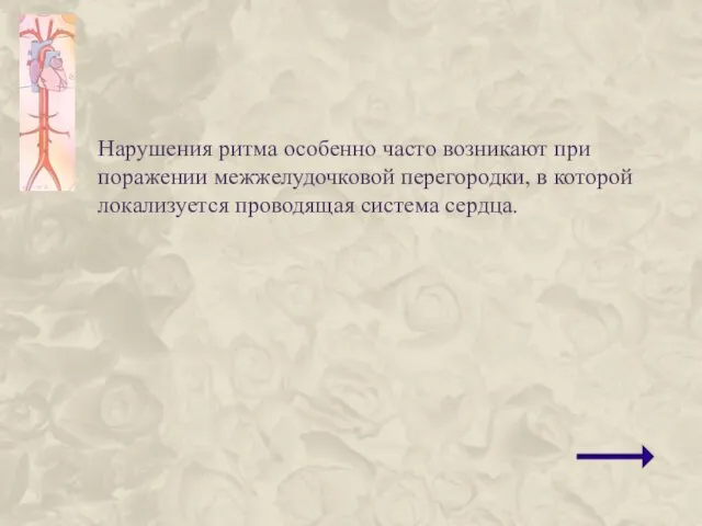 Нарушения ритма особенно часто возникают при поражении межжелудочковой перегородки, в которой локализуется проводящая система сердца.