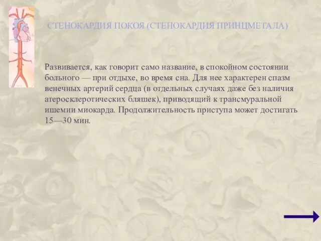 СТЕНОКАРДИЯ ПОКОЯ (СТЕНОКАРДИЯ ПРИНЦМЕТАЛА) Развивается, как говорит само название, в спокойном