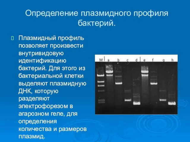 Определение плазмидного профиля бактерий. Плазмидный профиль позволяет произвести внутривидовую идентификацию бактерий.