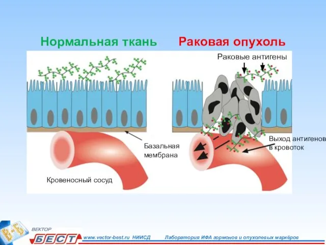 Базальная мембрана Кровеносный сосуд Выход антигенов в кровоток Раковые антигены Нормальная ткань Раковая опухоль