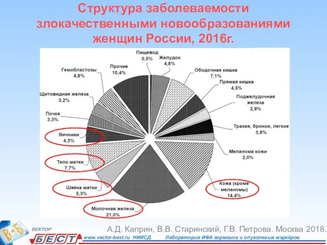 Структура заболеваемости злокачественными новообразованиями женщин России, 2016г. А.Д. Каприн, В.В. Старинский, Г.В. Петрова. Москва 2018.