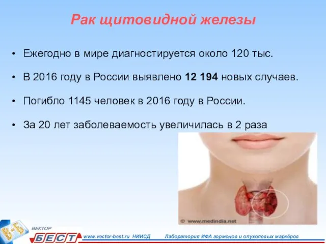 Ежегодно в мире диагностируется около 120 тыс. В 2016 году в