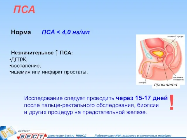 ПСА Норма ПСА Незначительное ↑ ПСА: ДГПЖ, воспаление, ишемия или инфаркт простаты.