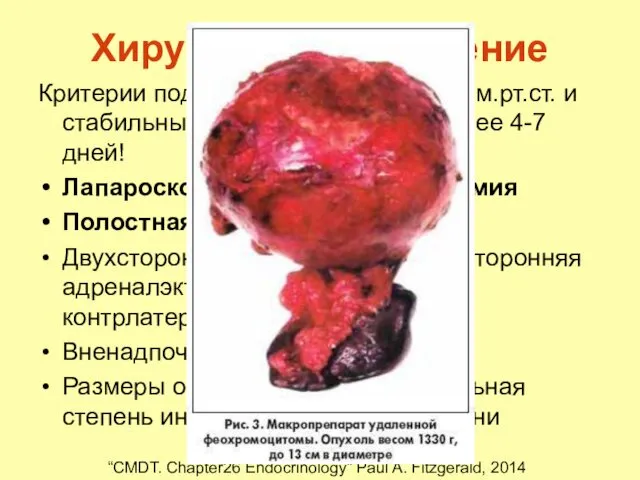 Хирургическое лечение Критерии подготовленности: 140/90 мм.рт.ст. и стабильные показатели ЭКГ не