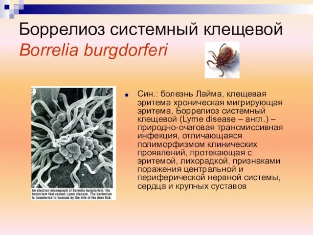 Син.: болезнь Лайма, клещевая эритема хроническая мигрирующая эритема, Боррелиоз системный клещевой