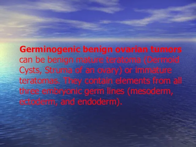 Germinogenic benign ovarian tumors can be benign mature teratoma (Dermoid Cysts,