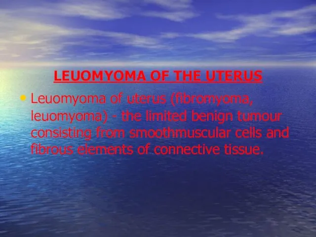 LEUOMYOMA OF THE UTERUS Leuomyoma of uterus (fibromyoma, leuomyoma) - the