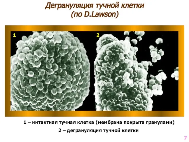 Дегрануляция тучной клетки (по D.Lawson) 1 – интактная тучная клетка (мембрана