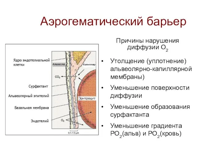 Аэрогематический барьер Причины нарушения диффузии О2 Утолщение (уплотнение) альвеолярно-капиллярной мембраны) Уменьшение