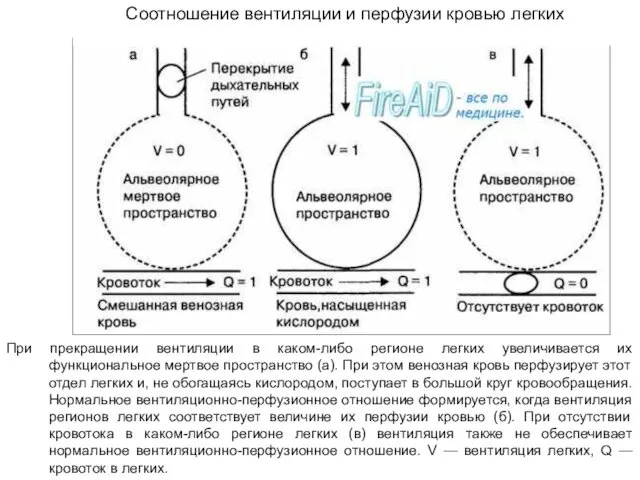 Соотношение вентиляции и перфузии кровью легких При прекращении вентиляции в каком-либо