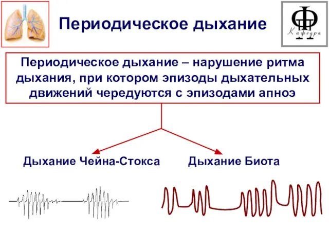 Периодическое дыхание – нарушение ритма дыхания, при котором эпизоды дыхательных движений