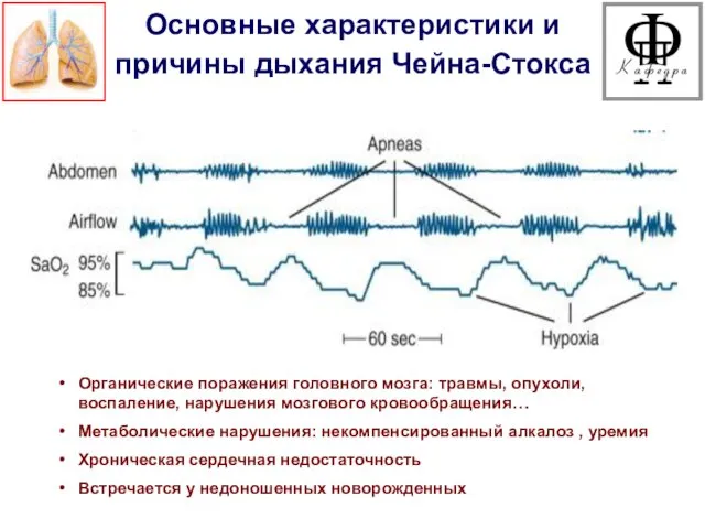 Основные характеристики и причины дыхания Чейна-Стокса Органические поражения головного мозга: травмы,