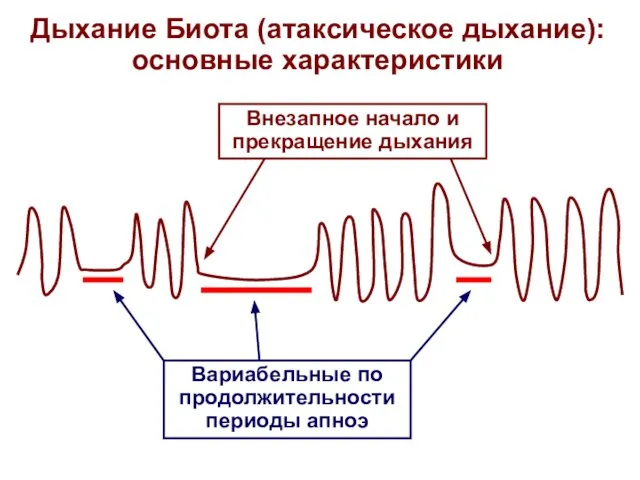 Вариабельные по продолжительности периоды апноэ Внезапное начало и прекращение дыхания Дыхание Биота (атаксическое дыхание): основные характеристики