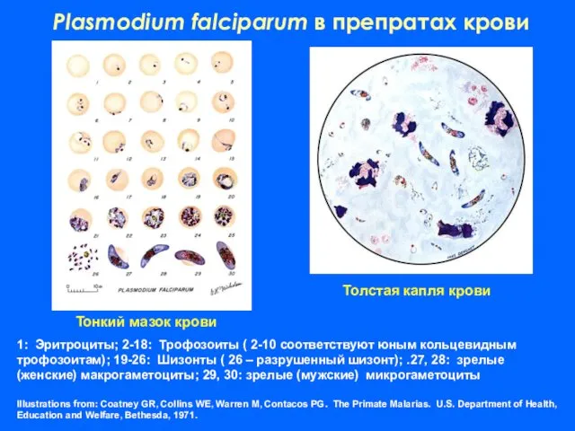 1: Эритроциты; 2-18: Трофозоиты ( 2-10 соответствуют юным кольцевидным трофозоитам); 19-26: