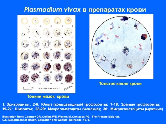 1: Эритроциты; 2-6: Юные (кольцевидные) трофозоиты; 7-18: Зрелые трофозоиты; 19-27: Шизонты;