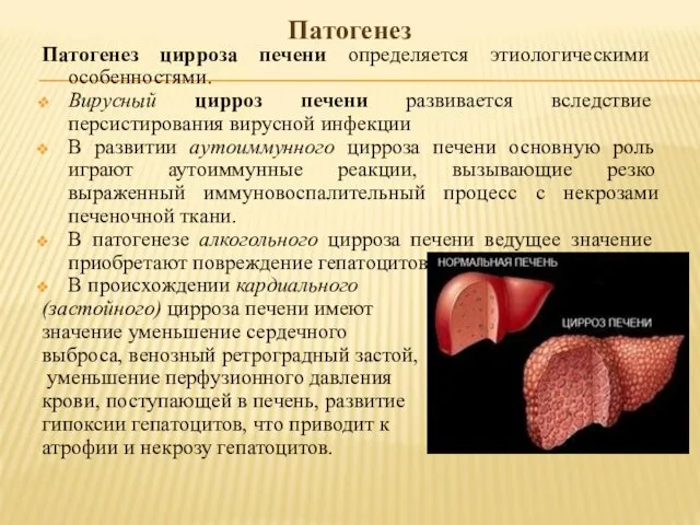 Патогенез Патогенез цирроза печени определяется этиологическими особенностями. Вирусный цирроз печени развивается