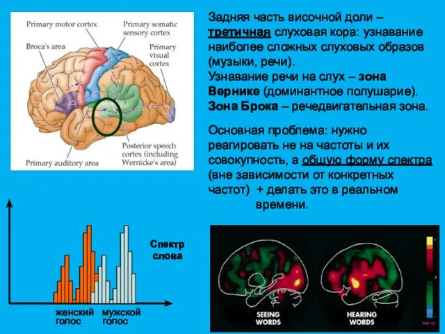 Задняя часть височной доли – третичная слуховая кора: узнавание наиболее сложных