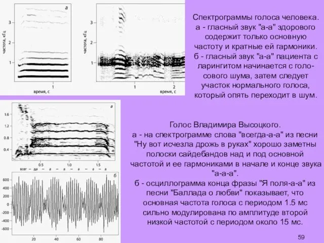 Спектрограммы голоса человека. а - гласный звук "а-а" здорового содержит только