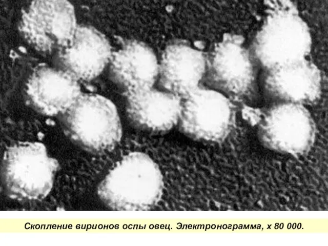 Скопление вирионов оспы овец. Электронограмма, х 80 000.